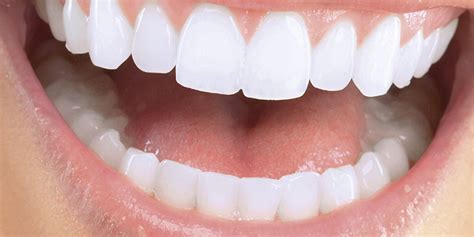 dientes de una persona